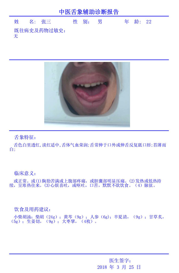 中醫(yī)舌診儀診斷報告