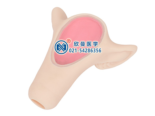 女性宮內(nèi)避孕器訓練模型