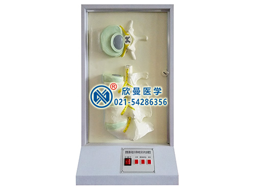 腰骶椎、椎間盤和脊神經(jīng)關(guān)系電動(dòng)模型