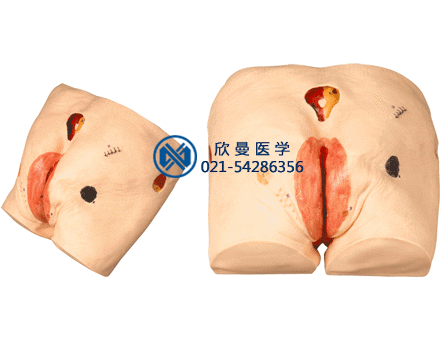 褥瘡護(hù)理模型，壓瘡護(hù)理模型