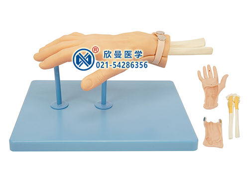 腕(手)關節(jié)鏡檢查模型